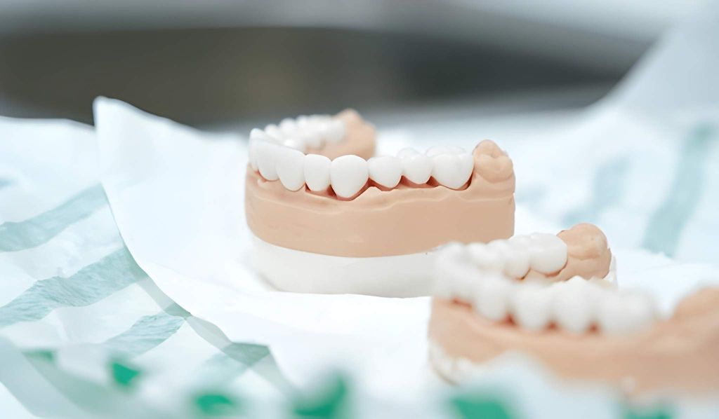 dental crowns near you
