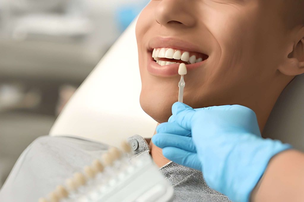 porcelain veneers in midtown toronto
