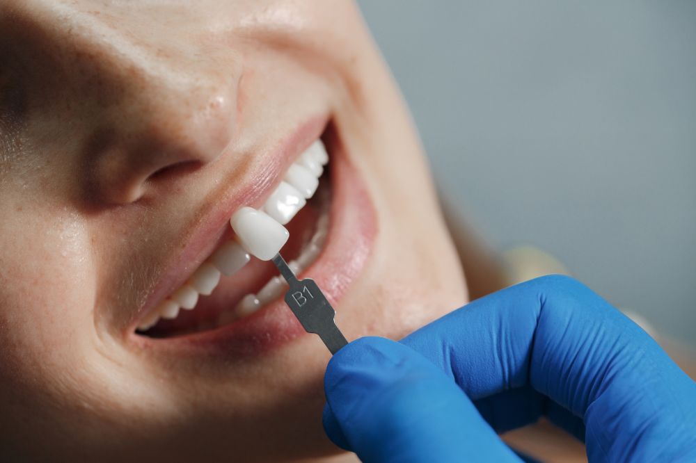 Dental Implants: What They Are & How They Work Explained